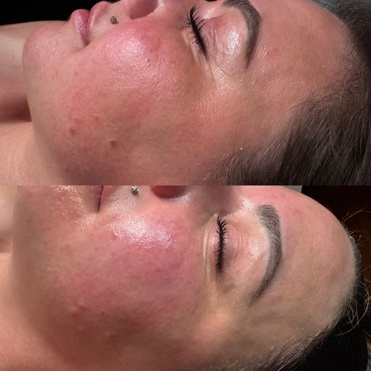 Skin transformation — before and after